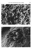 Bactéries dans partie intermédiaire du kéfir et levures au centre du grain de kéfir